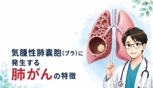 気腫性肺嚢胞（ブラ）に発生する肺がんの特徴を解説